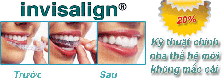 chinh nha invisalign