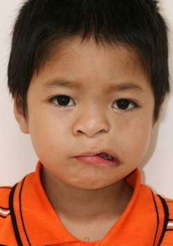 phau-thuat-ham-mat-2