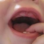 Cách chăm sóc khi trẻ mọc răng