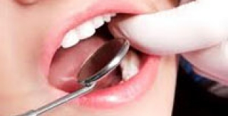 Hướng Dẫn về Bệnh Nha Chu