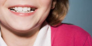 Chứng nghiến răng một cái nhìn tổng quát