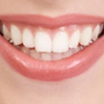 Răng sứ Zirconia là gì ? 