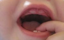 Để chăm sóc trẻ tốt khi mọc răng