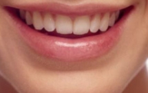 Các phương pháp Tẩy trắng răng