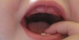 Cách chăm sóc khi trẻ mọc răng
