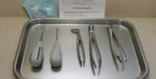 Nhổ răng khi nào, có nguy hiểm không?