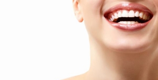 Niềng răng móm kèm răng chen chúc 