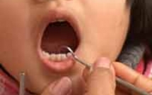 Chăm sóc răng cho trẻ nhỏ