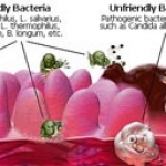 Vi khuẩn nào gây bệnh sâu răng