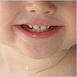 Những lệch lạc răng mặt ở trẻ em cần điều trị chỉnh hình răng hàm mặt sớm cho trẻ (Phần 1) 