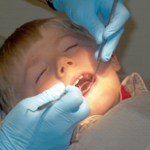 Giảm căng thẳng cho trẻ nhỏ khi khám, chữa răng 