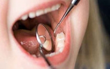 Tại sao cần phải bỏ công để trám những răng cối sữa?