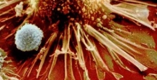 Vắc-xin HIV/AIDS: Thêm một hướng nghiên cứu mới 