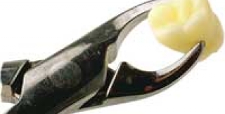 Những trường hợp cần lưu ý khi nhổ răng