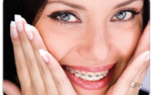 Bí quyết vệ sinh răng miệng khi nắn chỉnh răng